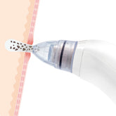 Elektrische Mee-eter Gezichtsreiniger