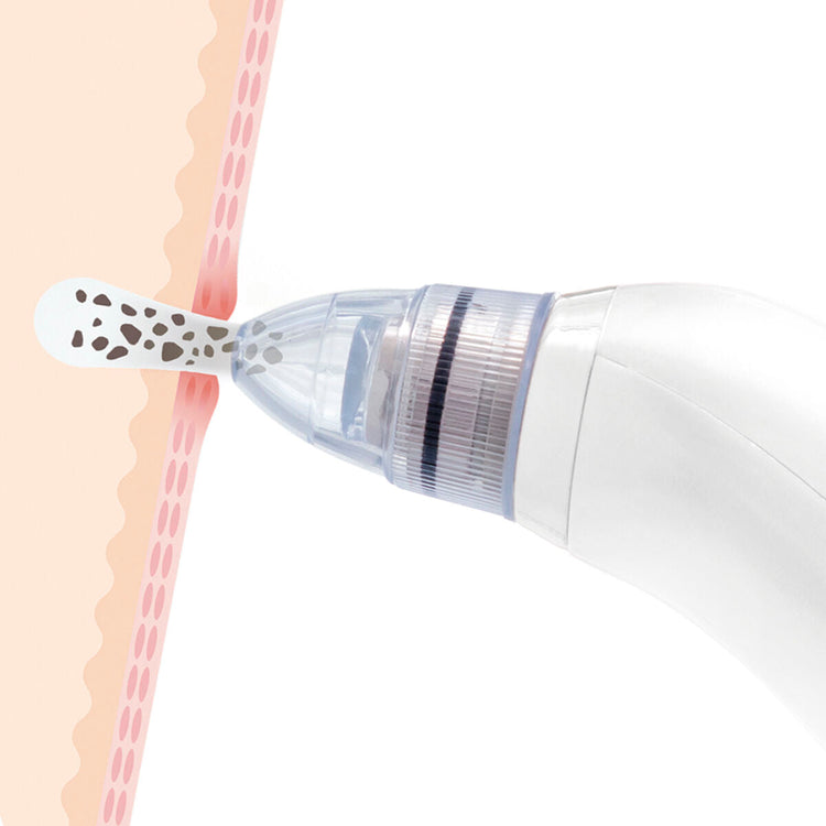 Elektrische Mee-eter Gezichtsreiniger